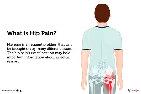 hip pain location chart Hip pain location diagram