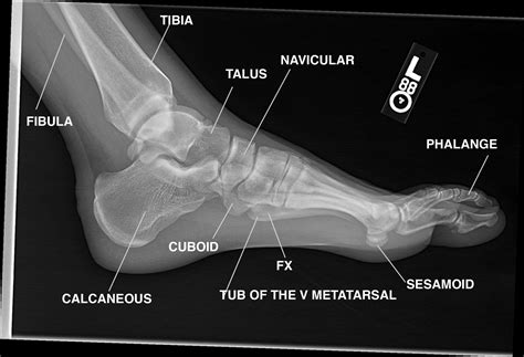 Pin by 👑Shayma👑 on Bones | Radiology student, Anatomy, Medical anatomy