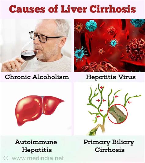 Liver Cirrhosis Causes