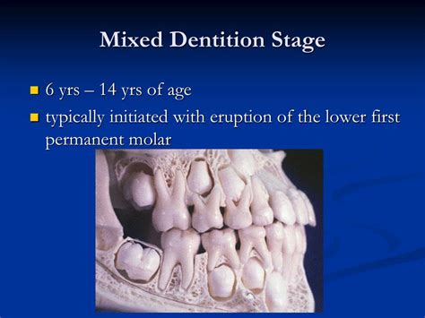 PPT - Pediatric Dentistry Seminar PowerPoint Presentation, free ...