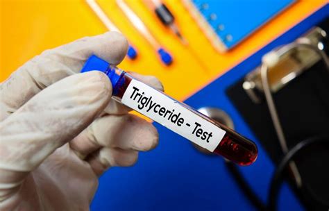 High Triglycerides:12 Common Causes with Treatment