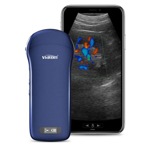 3 in 1 Wireless Ultrasound Scanner | Viatom