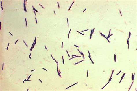 Difference Between Obligate Aerobes and Obligate Anaerobes | Compare ...