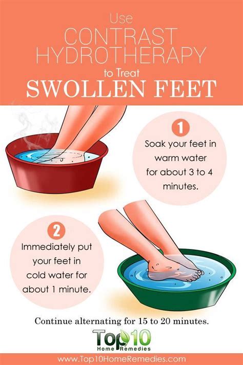 Top 10 Natural Home Remedies for Swollen Feet | Arthritis remedies ...