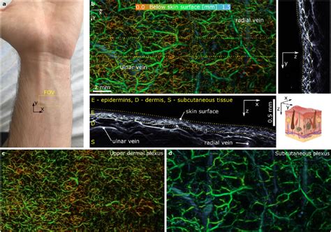 Application of cMBR to recover the vasculature in human skin. a ...