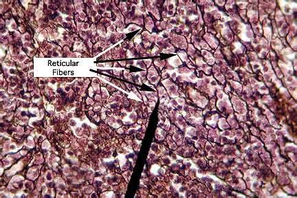 reticular fibers | Collagen fibers, Fiber, Anatomy and physiology