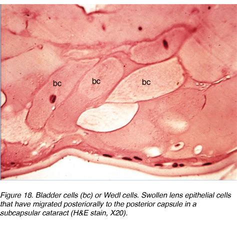 Lens Histology