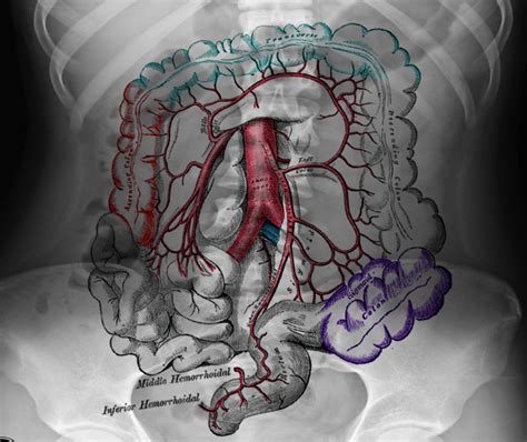 Anatomy, Abdomen and Pelvis, Sigmoid Colon Article