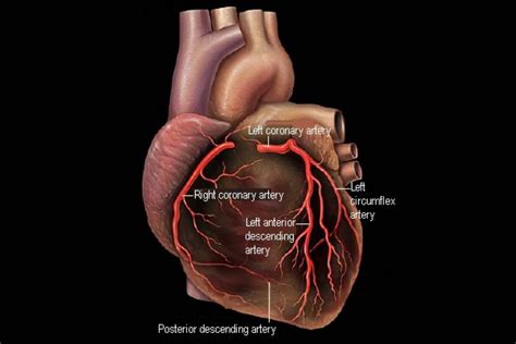 Coronary Arteries and Heart Disease