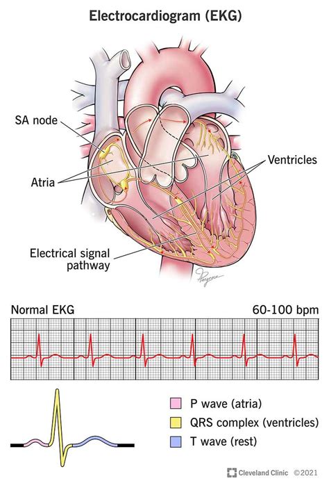 Electrocardiogram (EKG/ECG)