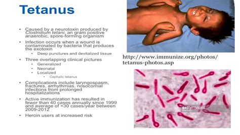 Clostridium Tetani Symptoms