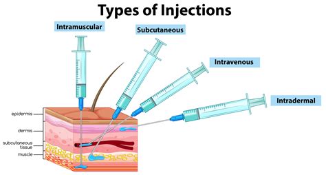 When you get shots from a doctor, exactly how far in are they pushing ...