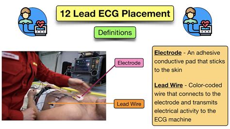 12 Lead ECG Placement: Diagram and Mnemonic for Limb and Precordial ...