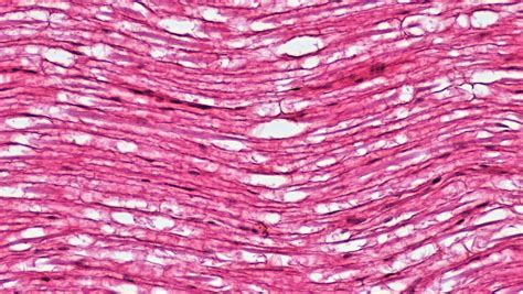 Mammalian Histology: Nervous Tissue – Berkshire Community College ...