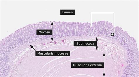 Dictionary - Normal: Colon - The Human Protein Atlas