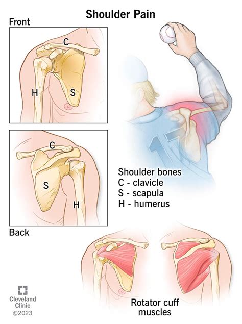 Shoulder Pain Causes & Treatment