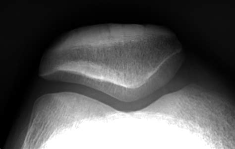 Diagnostics: Knee and Ankle X-rays — Taming the SRU