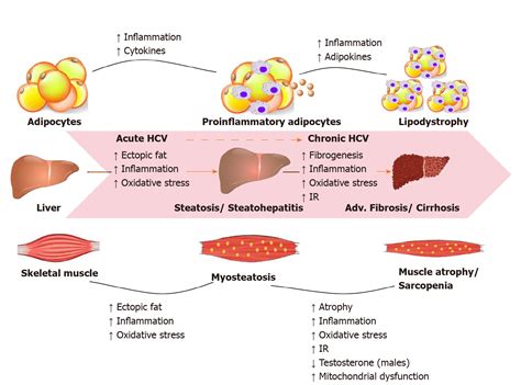 Metabolic complications of hepatitis C virus infection