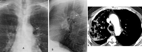 Image21 – European Diploma of Radiology