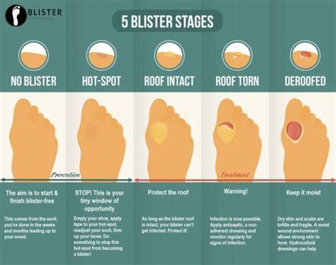 Foot Care & Blister Treatment > Trail Hiking Australia