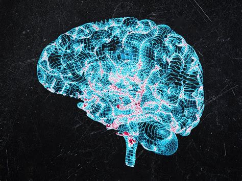 Dopamine and Parkinson's disease: What to know