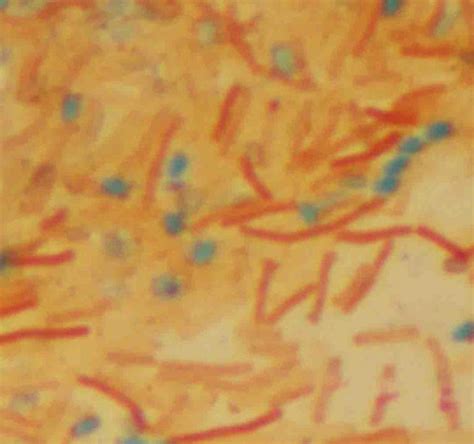 Endospore Bacterial Stain Procedure