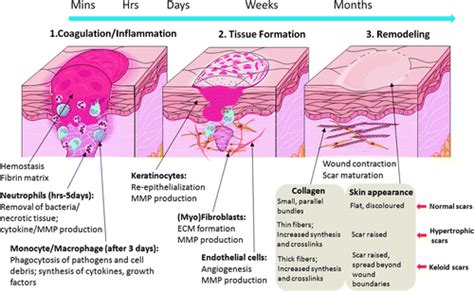 Surgical Wound Healing Stages