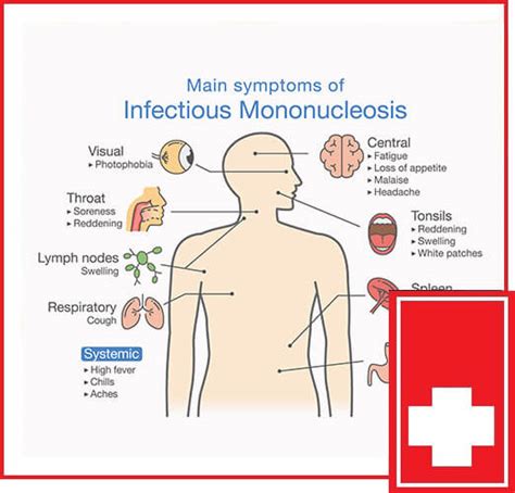 urgent care mono test - phil-hotek