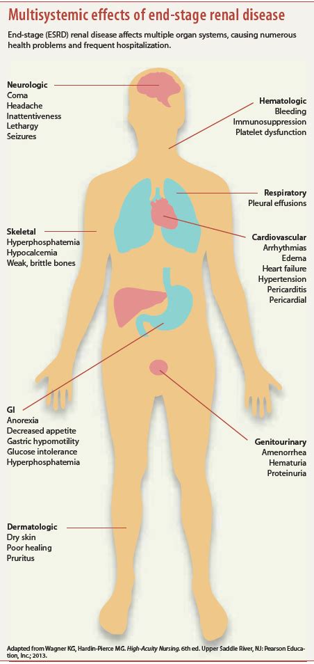 Acute kidney injury: Causes, phases, and early detection