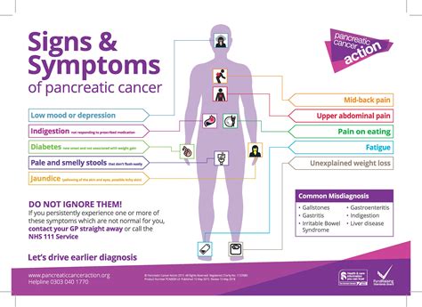 Pancreatic Cancer Symptoms : Pancreatic Cancer 16 Warning Signs You ...