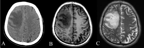 What is the Difference Between a CT Scan and an MRI? | ImageCare Centers