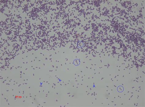 Enterobacter Aerogenes Gram Stain