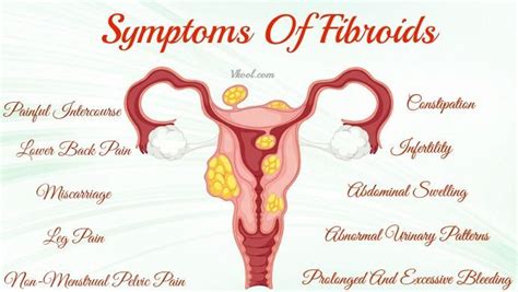 Fibroids Miracle™ Review | Fibroid uterus, Uterine fibroids symptoms ...