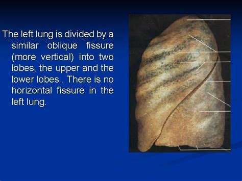 Lobes and fissures of lungs The right lung