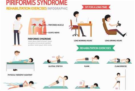 A Guide to Piriformis Syndrome - Amazing Life Chiropractic and Wellness