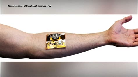 'Smart bandages' of the future could monitor wound healing, dispense ...