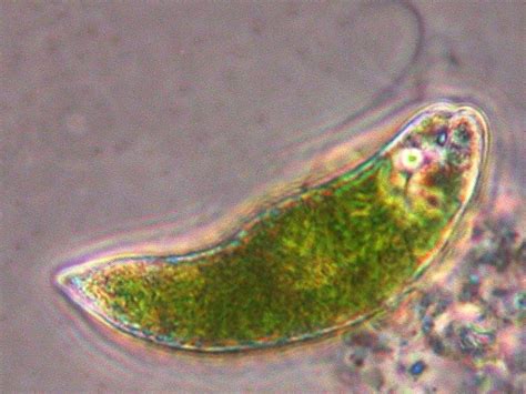 Life as we know it: Kingdom Protista