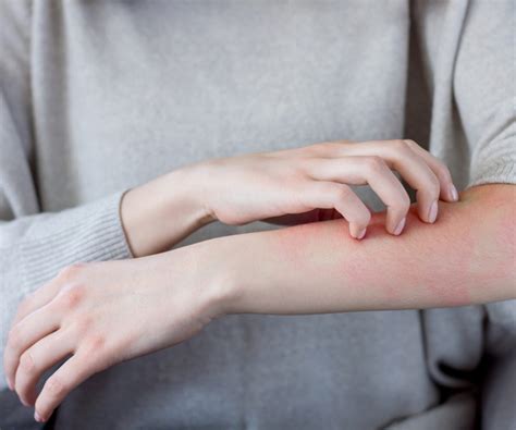 Maculopapular Rash: Causes, Treatment, and More