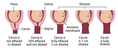 how to feel if the cervix is dilated - He Has Nice Webcast Image Library