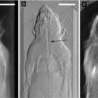 (PDF) In-vivo dark-field and phase-contrast x-ray imaging