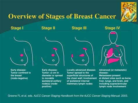 Stages Of Cancer