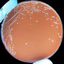 Haemophilus influenzae - Wikipedia