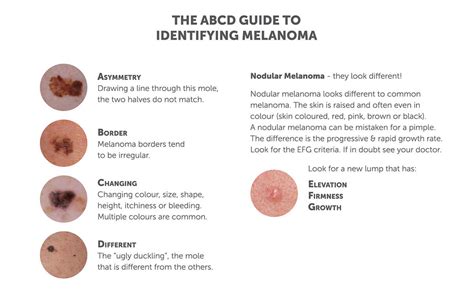 Melanoma Skin Cancer Symptoms And Signs