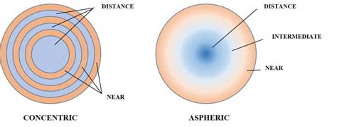 Multifocal Contact Lenses | Weber Vision Care