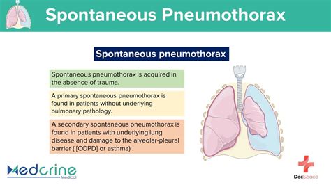 Pneumothorax Causes