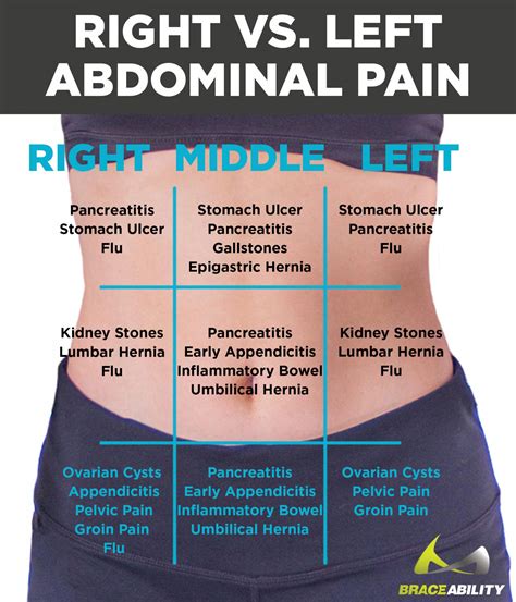 Left vs. Right Back and Abdominal Pain in Women