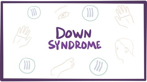 Down syndrome (Trisomy 21): Video, Causes, & Meaning | Osmosis