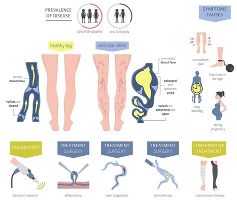 Chronic Venous Insufficiency: Causes, Symptoms And, 53% OFF