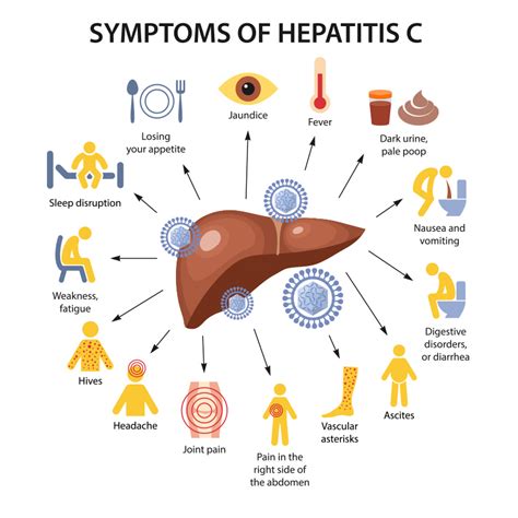 Hepatitis C Symptoms - Image to u