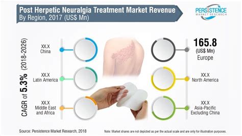 Global Post Herpetic Neuralgia Treatment to Reap Over US$ 908.4 Mn, In ...